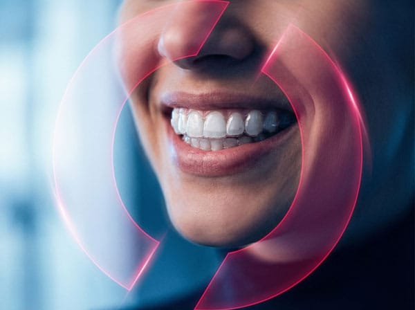 Invisalign Aligner Behandlung – KFO Heidelberg & Dossenheim