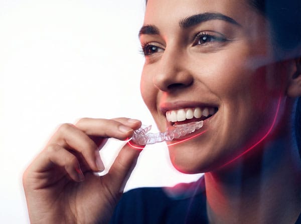 Invisalign Aligner Behandlung – KFO Heidelberg & Dossenheim